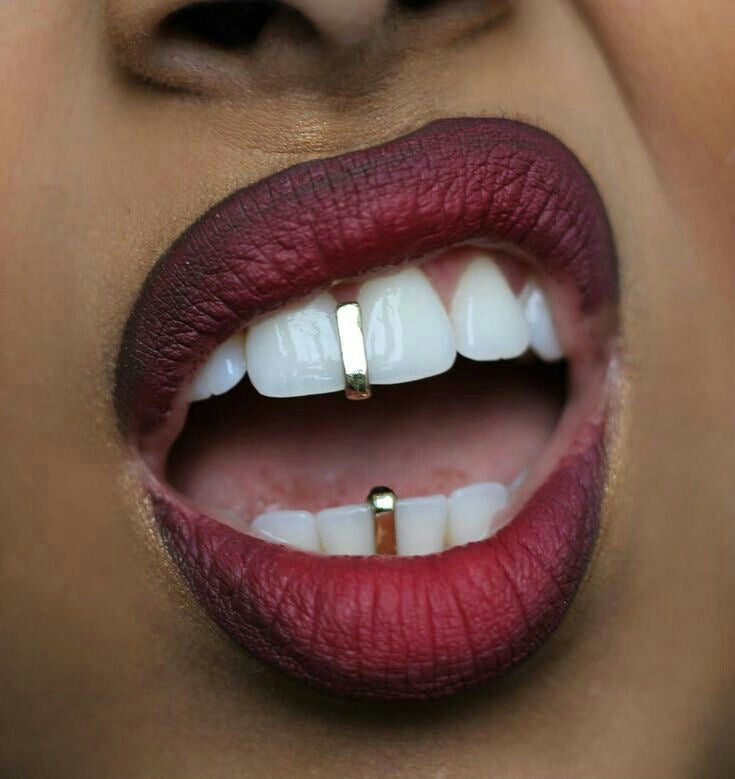 Gouden spleet filler