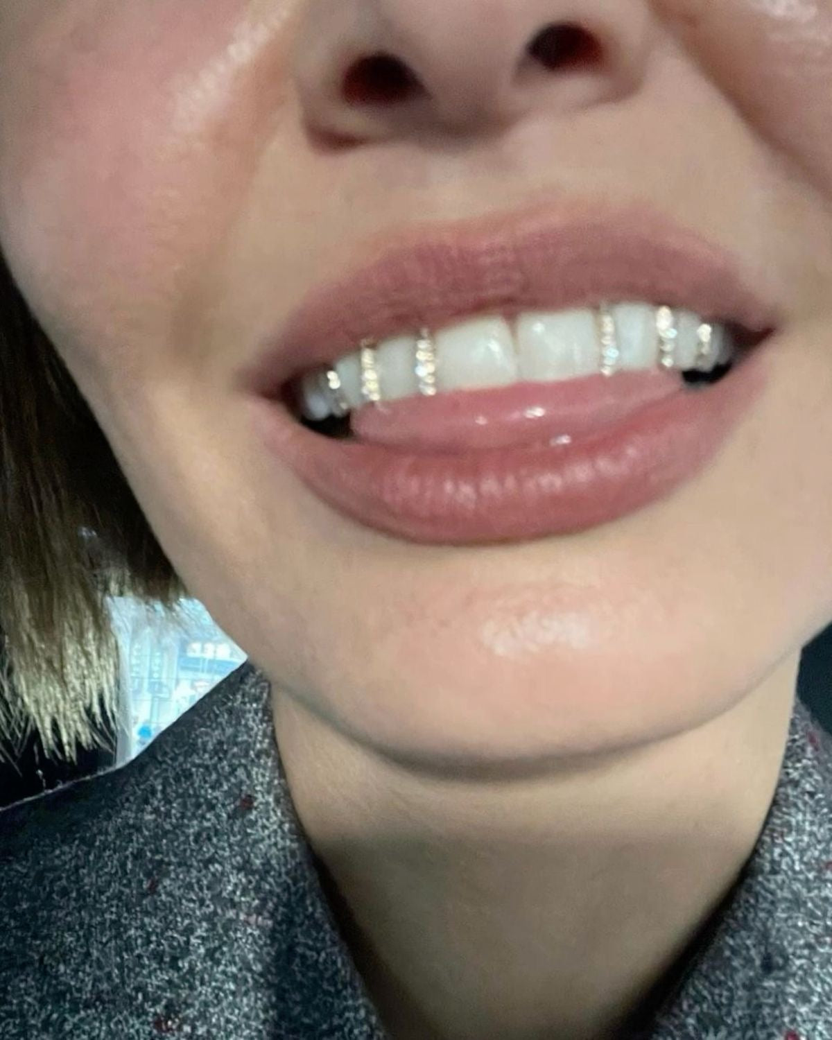 Spleet filler met diamanten