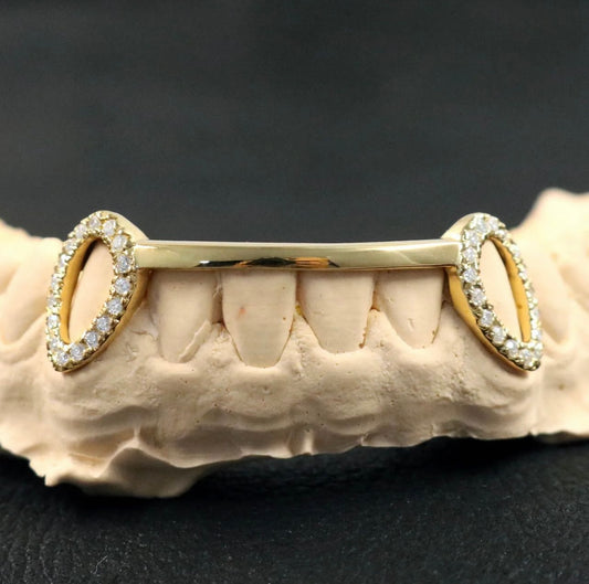 Gouden diamanten frame grillz