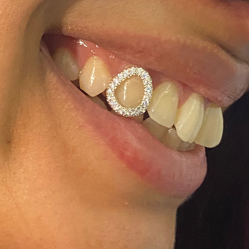 Diamanten frame grillz